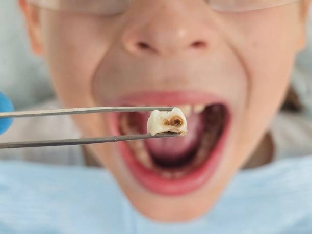 Best Emergency Dental Care for Trauma or Injury in Adamsville, TN