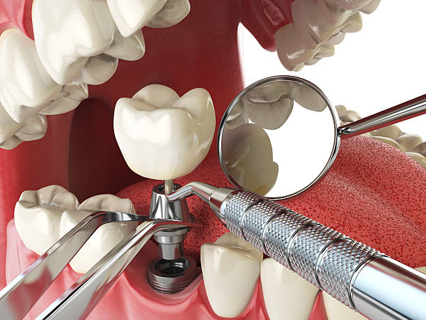 Best Emergency Treatment for Toothache in Adamsville, TN